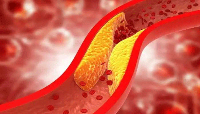 Cholesterol in Between Blood