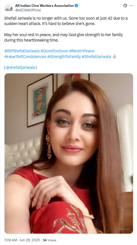 Kaanta Laga Fame Actress Shefali Jariwala Passed Away at age 42