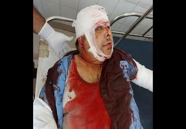 Punjab Shiv Sena Leader Attack