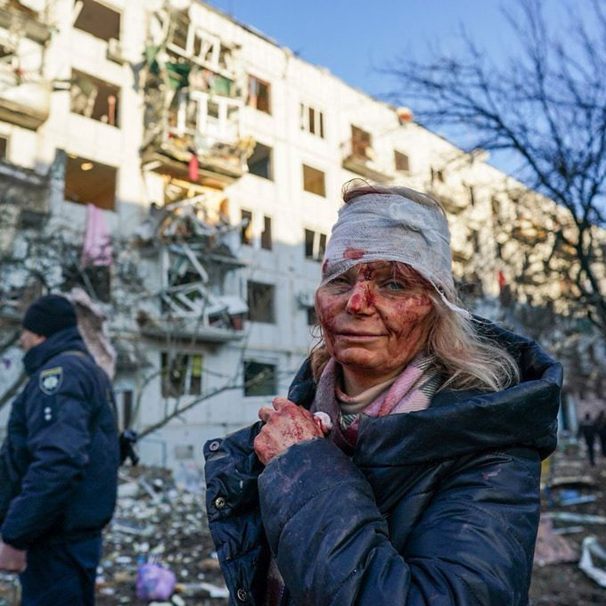 Russia Ukraine War Father Daughter Viral Video