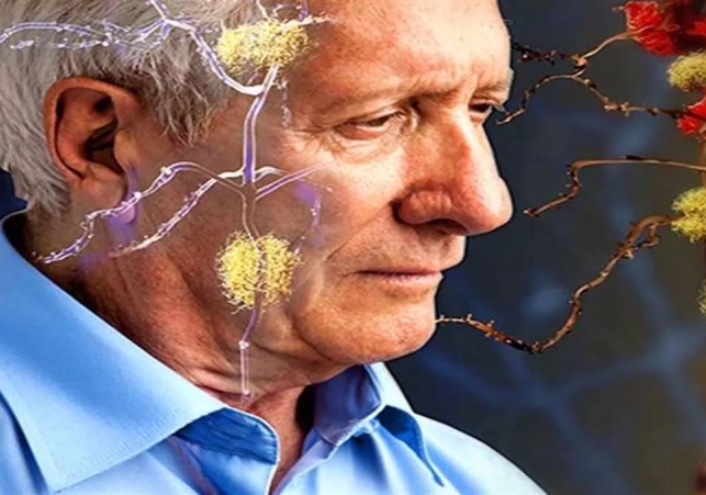 Alzheimers Disease Prevention