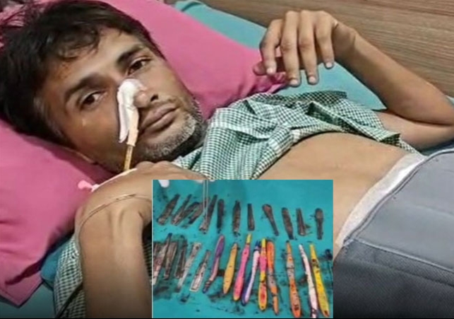 28 Spoons 19 Tooth Brush Came Out of The Man Stomach After Long Opreshan