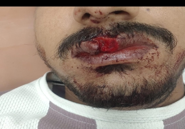Robbers flee after severely injuring victim
