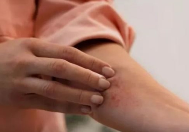 AI-based neural network could make lupus