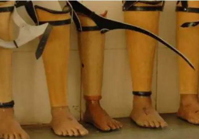 Artificial Limbs for Disabled Persons