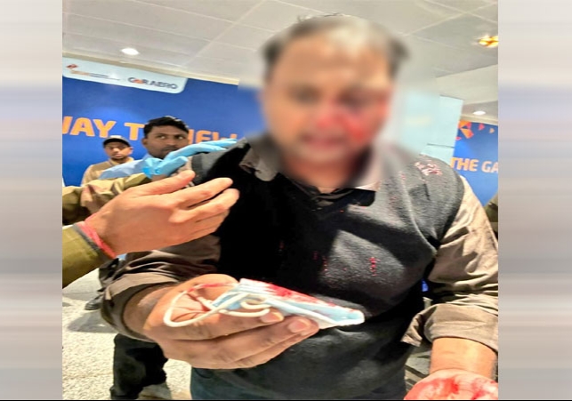 दिल्ली एयरपोर्ट पर पायलट की यात्री से खूनी मारपीट; बेटी के सामने हमले में यात्री का चेहरा लहूलुहान हुआ, एयरलाइन ने लिया बड़ा एक्शन