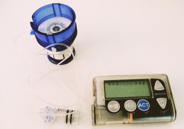 Insulin pump introduced for type-a diabetes 