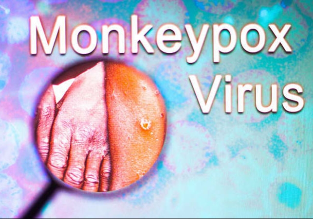 MonkeyPox Name change