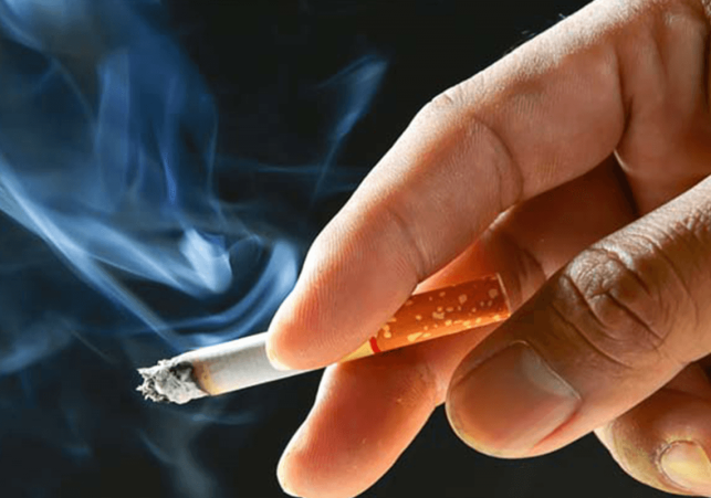 Smocking