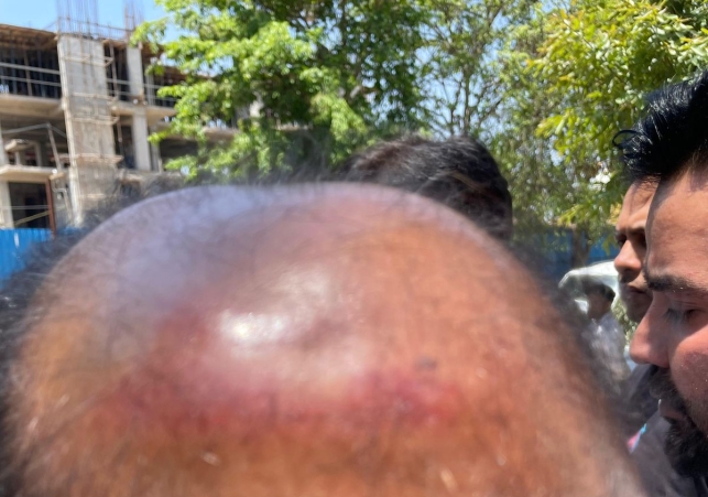 Former IAS Officer S.R. Ladhar Attacked
