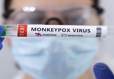 Monkeypox Cases in India: मंकीपाक्स को लेकर भारत में भी बढ़ा खतरा