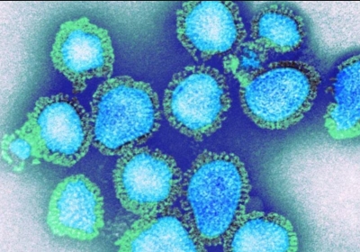 Influenza Virus H3N2 Risk