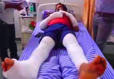 Haryana Girlfriend Broke The Both Arms and Legs of Her Boyfriend