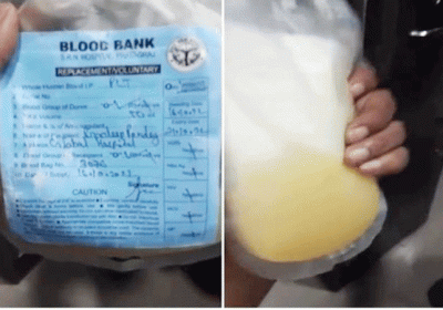 Hospital Gave Mausami Juice To Dengue Patient Instead Platelets