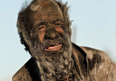 World Most Dirtiest Man Die