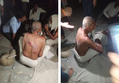 Anger in the Entire Jain Community due to the Assault
