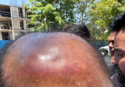 Former IAS Officer S.R. Ladhar Attacked