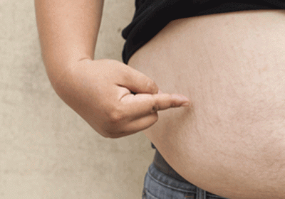 Excessive obesity can cause 16 common diseases