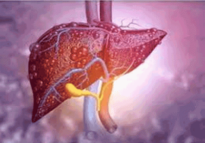 This therapy can cure liver cancer patients