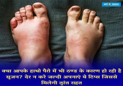 Tips for swelling in toes and hands finger in winter.