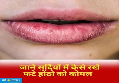 How to protect your lips from dryness in winter.