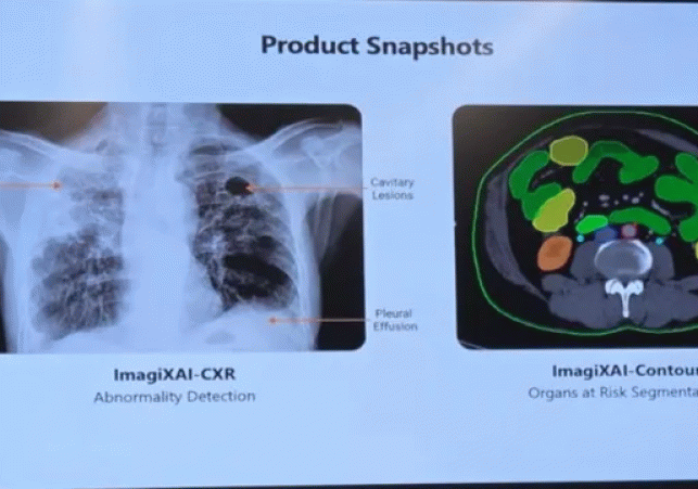 Greater Noida: Image AI generates X-ray