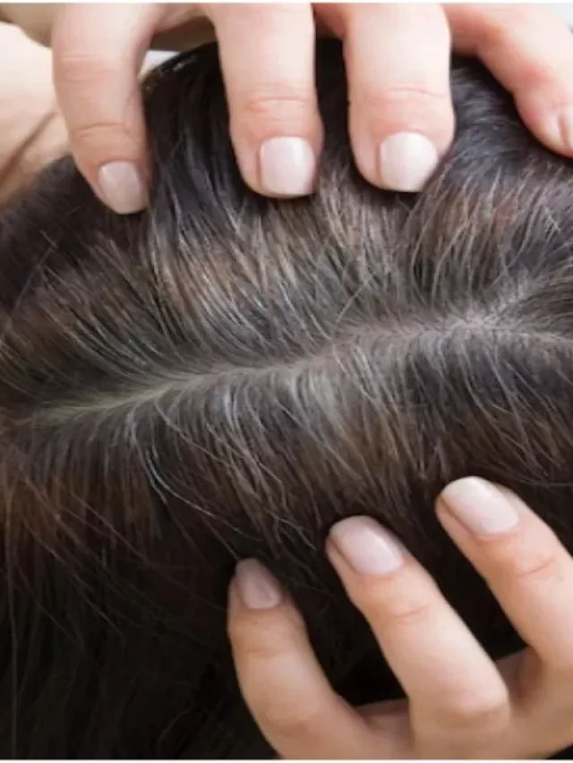 डिलीवरी के बाद बालों को झड़ने से कैसे रोकें? जानें उपाय